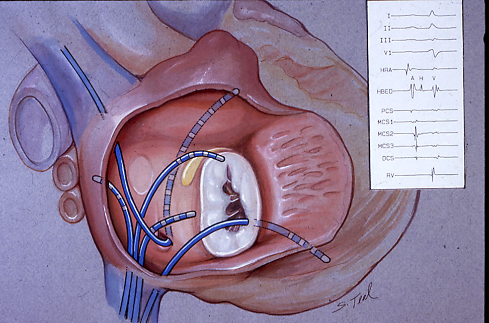 What s Electrophysiology Dr John M